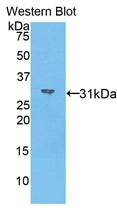 DAB staining on IHC-P; Samples: Mouse Testis Tissue; Primary Ab: 20µg/ml Rabbit Anti-Mouse MYO1A Antibody Second Ab: 2µg/mL HRP-Linked Caprine Anti-Rabbit IgG Polyclonal Antibody