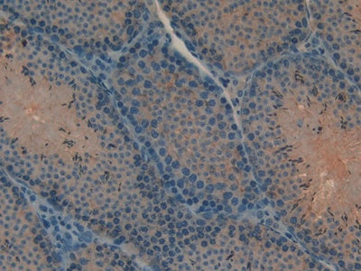 DAB staining on IHC-P; Samples: Mouse Lung Tissue.