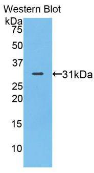 Western Blot; Sample: Porcine Small intestine lysate; Primary Ab: 1μg/ml Rabbit Anti-Human MYO1A Antibody; Second Ab: 0.2µg/mL HRP-Linked Caprine Anti-Rabbit IgG Polyclonal Antibody;