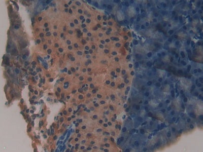DAB staining on fromalin fixed paraffin-embedded Kidney tissue)