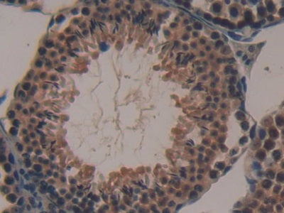 Acyl Carrier Protein, Mitochondrial (ACP) Polyclonal Antibody - image 4