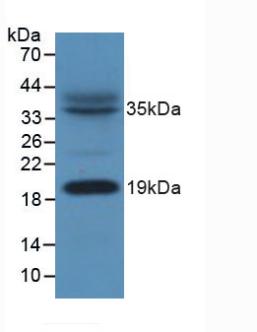 Western Blot; Sample: Recombinant ACP, Human.