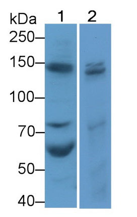 DAB staining on IHC-P; Samples: Mouse Lymph node Tissue; Primary Ab: 20µg/ml Rabbit Anti-Mouse COL1a1 Antibody Second Ab: 2µg/mL HRP-Linked Caprine Anti-Rabbit IgG Polyclonal Antibody