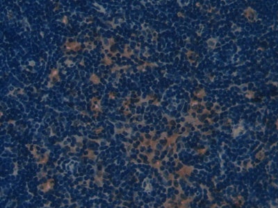 DAB staining on fromalin fixed paraffin- embedded kidney tissue)