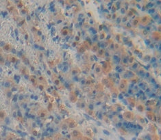 Fatty Acid Binding Protein 6, Ileal (FABP6) Polyclonal Antibody - image 3