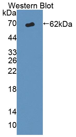 ATP Binding Cassette Transporter D1 (ABCD1) Polyclonal Antibody - image 2