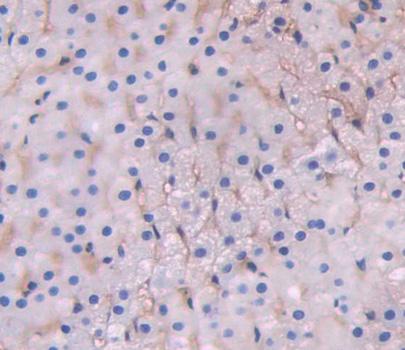 ATP Binding Cassette Transporter D1 (ABCD1) Polyclonal Antibody - image 3