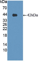 DAB staining on IHC-P; Samples: Human Stomach Tissue;  Primary Ab: 30µg/ml Rabbit Anti-Human LPHN3 A