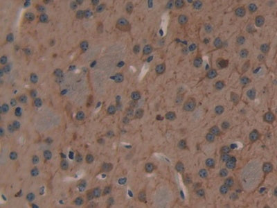 DAB staining on IHC-P; Samples: Mouse Heart Tissue.