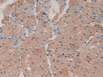 Microtubule Associated Protein 1A (MAP1A) Polyclonal Antibody - image 5