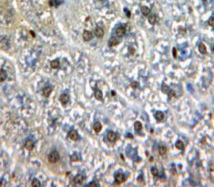 GATA Binding Protein 1 (GATA1) Polyclonal Antibody - image 4