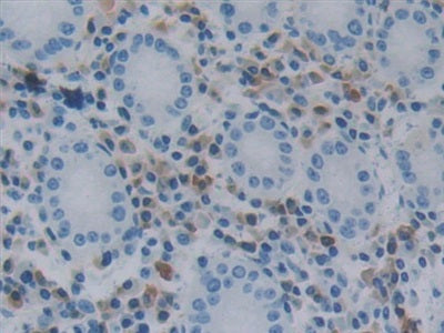 DAB staining on IHC-P; Samples: Human Kidney Tissue