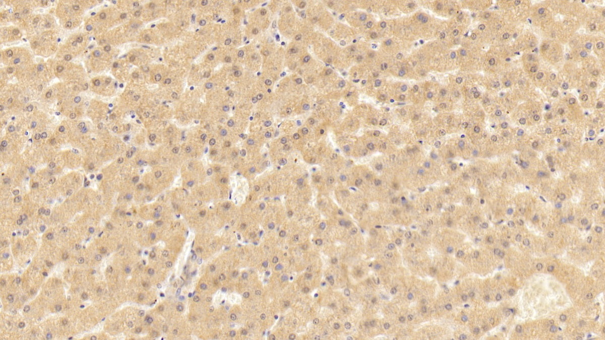 Neutrophil Cytosolic Factor 4 (NCF4) Polyclonal Antibody - image 3