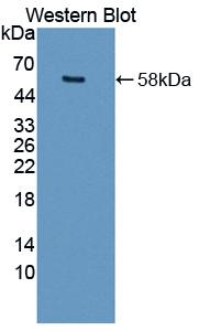 Matrix Metalloproteinase 15 (MMP15) Polyclonal Antibody - image 2