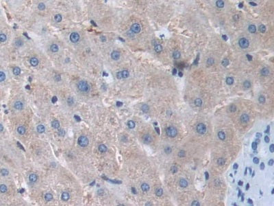 DAB staining on fromalin fixed paraffin-embedded liver tissue)