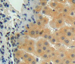 Matrix Metalloproteinase 15 (MMP15) Polyclonal Antibody - image 4