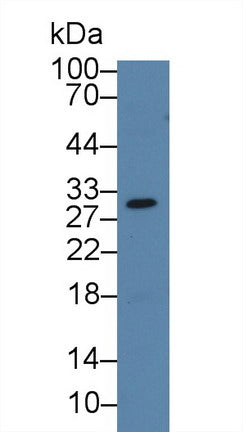 Western Blot; Sample: Recombinant protein.