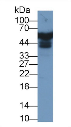 Western Blot; Sample: Recombinant protein.
