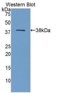 DAB staining on IHC-P; Samples: Human Placenta Tissue; Primary Ab: 20μg/ml Rabbit Anti-Human APOH Antibody Second Ab: 2µg/mL HRP-Linked Caprine Anti-Rabbit IgG Polyclonal Antibody