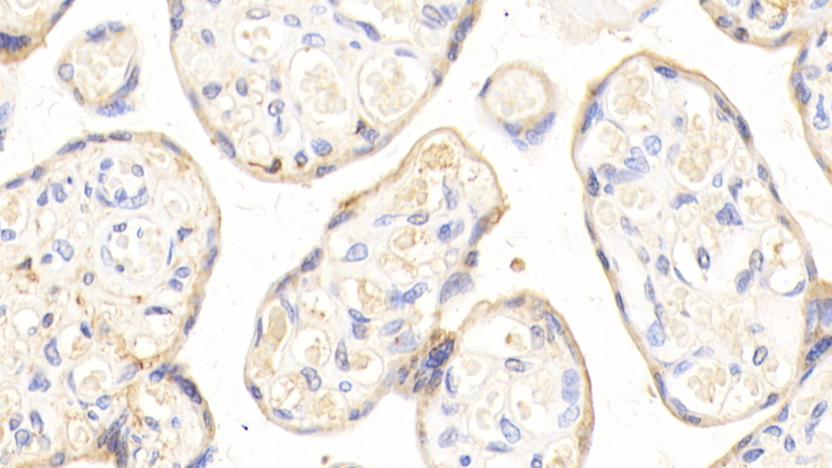 DAB staining on fromalin fixed paraffin-embedded Liver tissue)