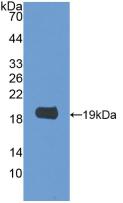 DAB staining on IHC-P; Samples: Rat Small intestine Tissue; Primary Ab: 30µg/ml Rabbit Anti-Rat GAL2 Antibody Second Ab: 2µg/mL HRP-Linked Caprine Anti-Rabbit IgG Polyclonal Antibody