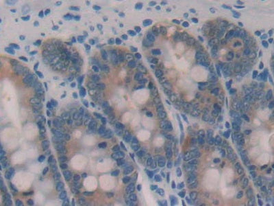 DAB staining on IHC-P; Samples: Rat Stomach Tissue
