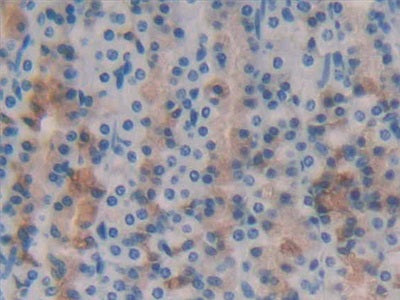 Galectin 2 (GAL2) Polyclonal Antibody - image 5