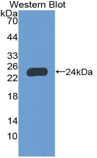 Used in DAB staining on fromalin fixed paraffin-embedded Pancreas tissue