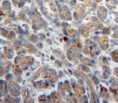 Neutrophil Cytosolic Factor 2 (NCF2) Polyclonal Antibody - image 4