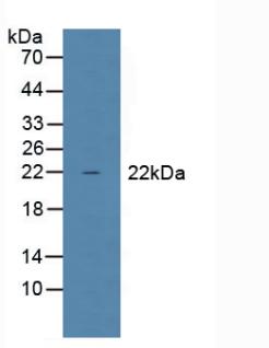 Western Blot; Sample: Recombinant GPX1, Human.