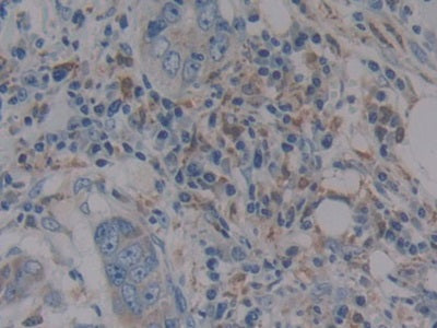 DAB staining on IHC-P; Samples: Human Stomach Tissue.