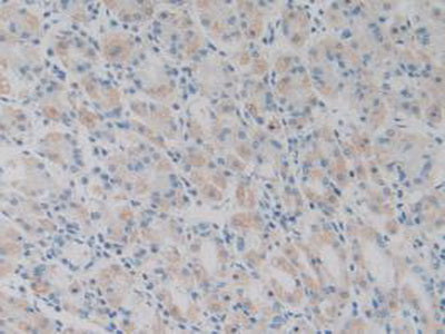 Glutathione Peroxidase 1 (GPX1) Polyclonal Antibody - image 5
