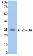 Alpha-Fodrin (SPTAN1) Polyclonal Antibody - image 2