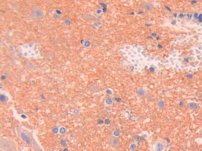 DAB staining on IHC-P; Samples: Rat Pancreas Tissue