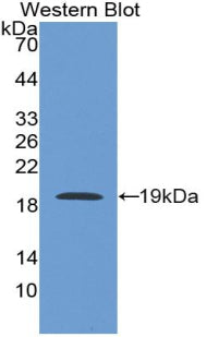 Alpha-Fodrin (SPTAN1) Polyclonal Antibody - image 2