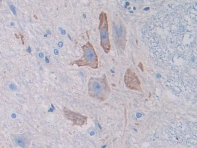 DAB staining on IHC-P; Samples: Rat Spinal cord Tissue)