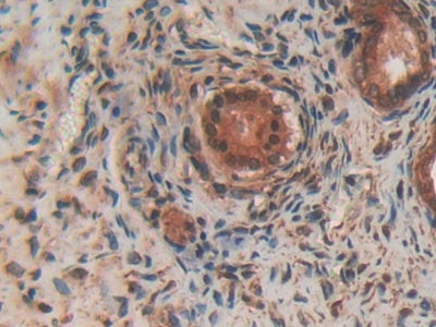 DAB staining on fromalin fixed paraffin- embedded stomach tissue)