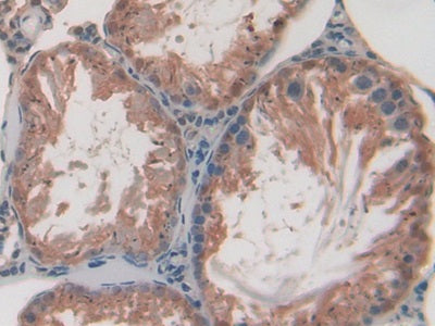 Alpha-Fodrin (SPTAN1) Polyclonal Antibody - image 5