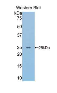 Alpha-Fodrin (SPTAN1) Polyclonal Antibody - image 2