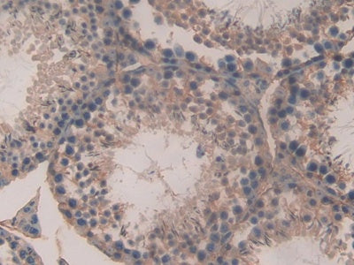 DAB staining on IHC-P; Samples: Mouse Testis Tissue)