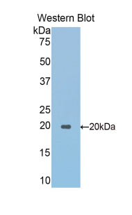 Alpha-Fodrin (SPTAN1) Polyclonal Antibody - image 2
