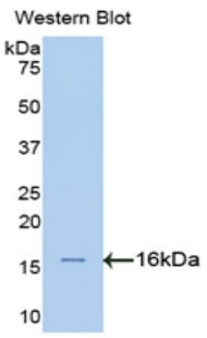 Western Blot; Sample: Lane1: Human Lung lysate; Lane2: Rat Cerebrum lysate; Lane3: Hela cell lysate; Lane4: U2OS cell lysate; Primary Ab: 2μg/ml Rabbit Anti-Human SPTAN1 Antibody; Second Ab: 0.2µg/mL HRP-Linked Caprine Anti-Rabbit IgG Polyclonal Antibody;