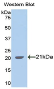 DAB staining on IHC-P; Samples: Human Kidney Tissue; Primary Ab: 20μg/ml Rabbit Anti-Human SPTAN1 Antibody Second Ab: 2µg/mL HRP-Linked Caprine Anti-Rabbit IgG Polyclonal Antibody