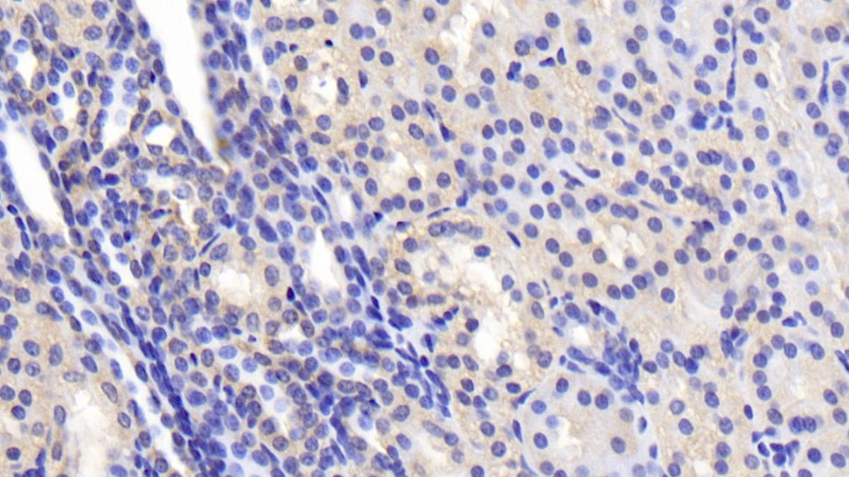 DAB staining on IHC-P. Samples: Human Tissue)