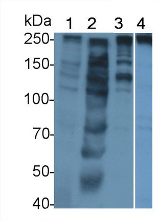 DAB staining on IHC-P; Samples: Human Kidney Tissue; Primary Ab: 20µg/ml Rabbit Anti-Human SPTAN1 Antibody Second Ab: 2µg/mL HRP-Linked Caprine Anti-Rabbit IgG Polyclonal Antibody