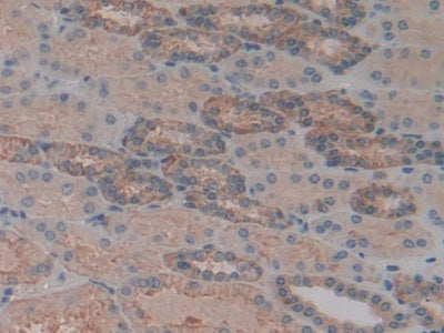 DAB staining on IHC-P; Samples: Human Liver Tissue