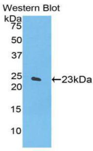 Alpha-Fodrin (SPTAN1) Polyclonal Antibody - image 2