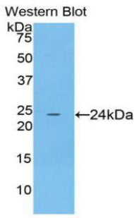 Alpha-Fodrin (SPTAN1) Polyclonal Antibody - image 2