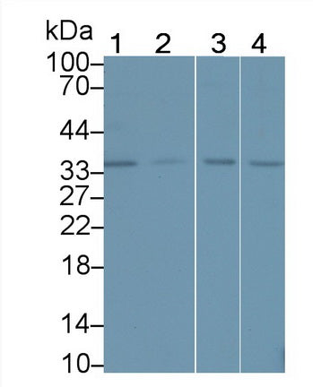 DAB staining on IHC-P; Samples: Human Kidney Tissue;  Primary Ab: 20µg/ml Rabbit Anti-Human IGFBP6 A