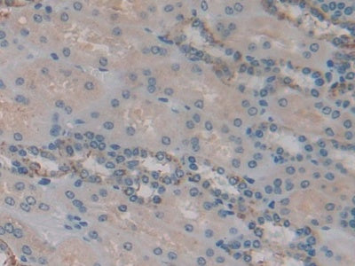 Insulin Like Growth Factor Binding Protein 6 (IGFBP6) Polyclonal Antibody - image 4